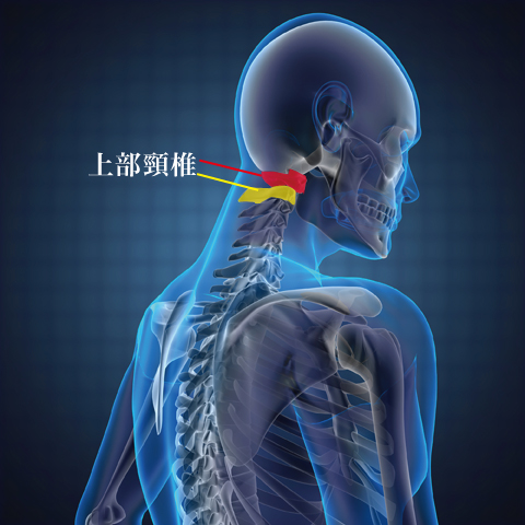 カイロプラクティック適応症状