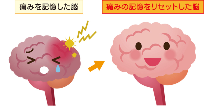 痛みの記憶をリセットする